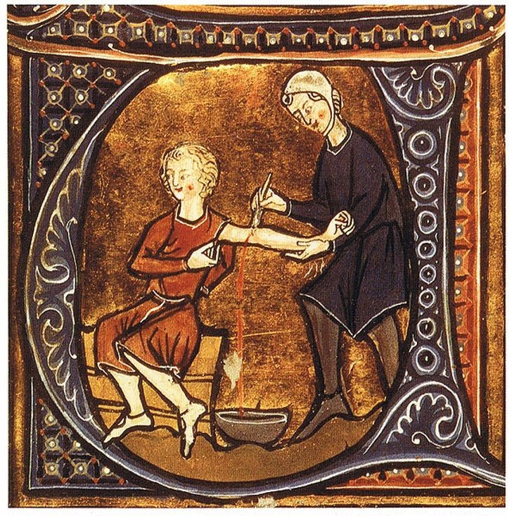 ilustração antiga da prática da sangria