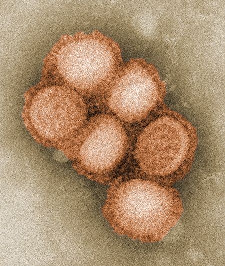 Imagem do vírus que causa a gripe A