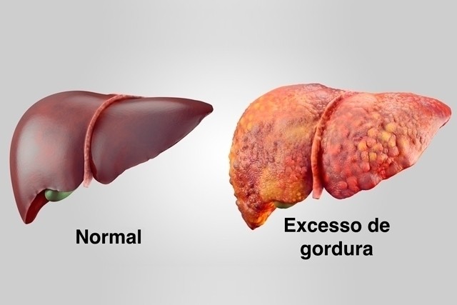 imagem de um fígado