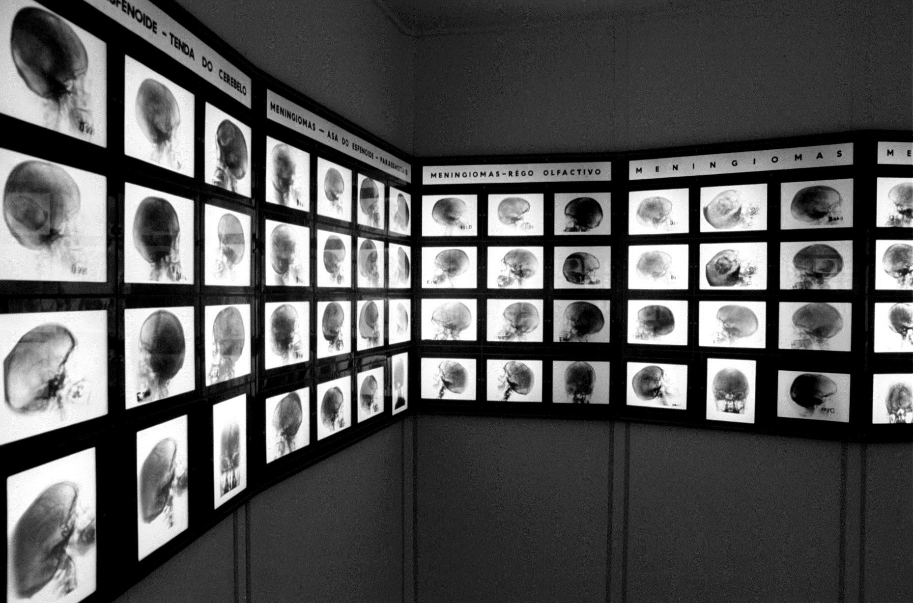 xposição sobre a técnica da Angiografia no Museu Egas Moniz, na Universidade de Lisboa DAVID CLIFFORD - PÚBLICO ARQUIVO